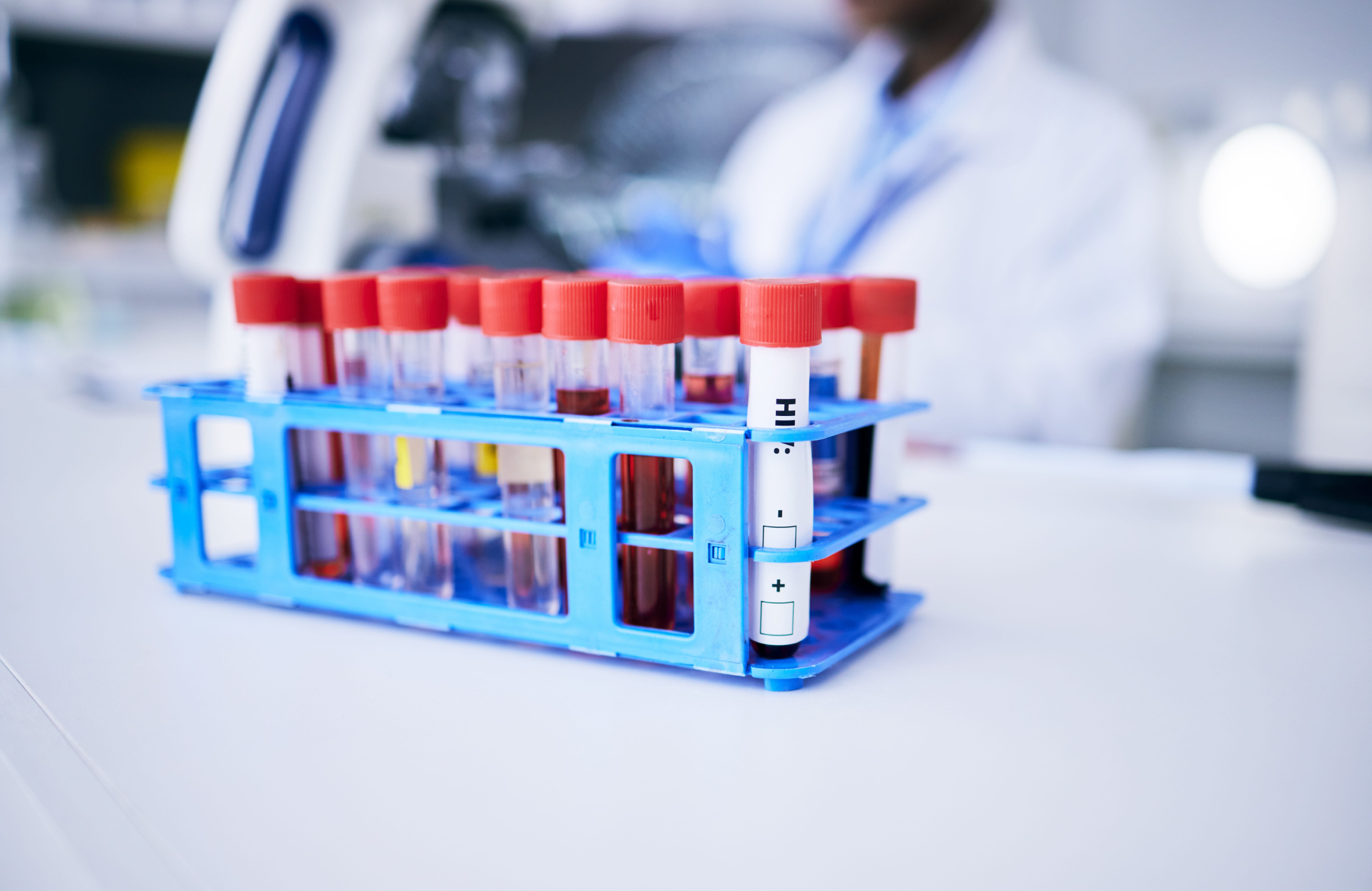 A Modern Marvel – Lyophilization Stoppers