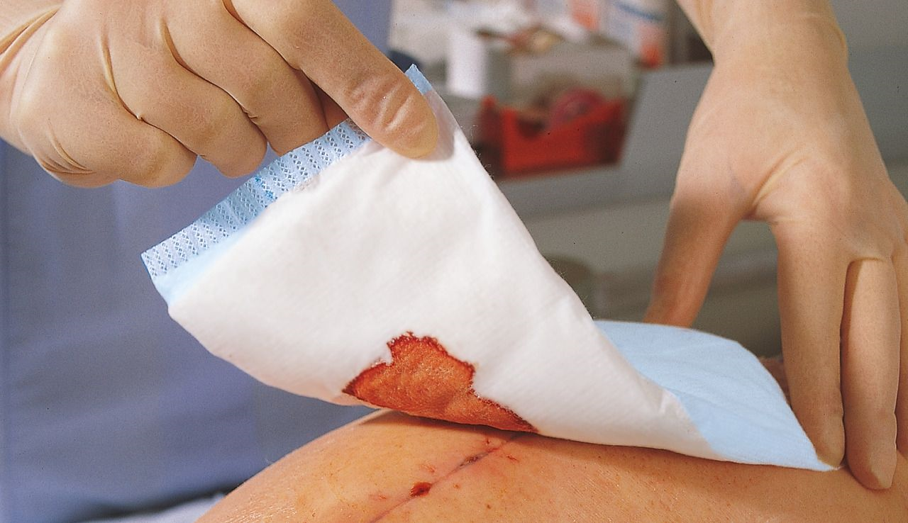 Sorbalux ABD Pad 48700000, 5 X 9 Inch, Sterile, Latex Free, Box of 25