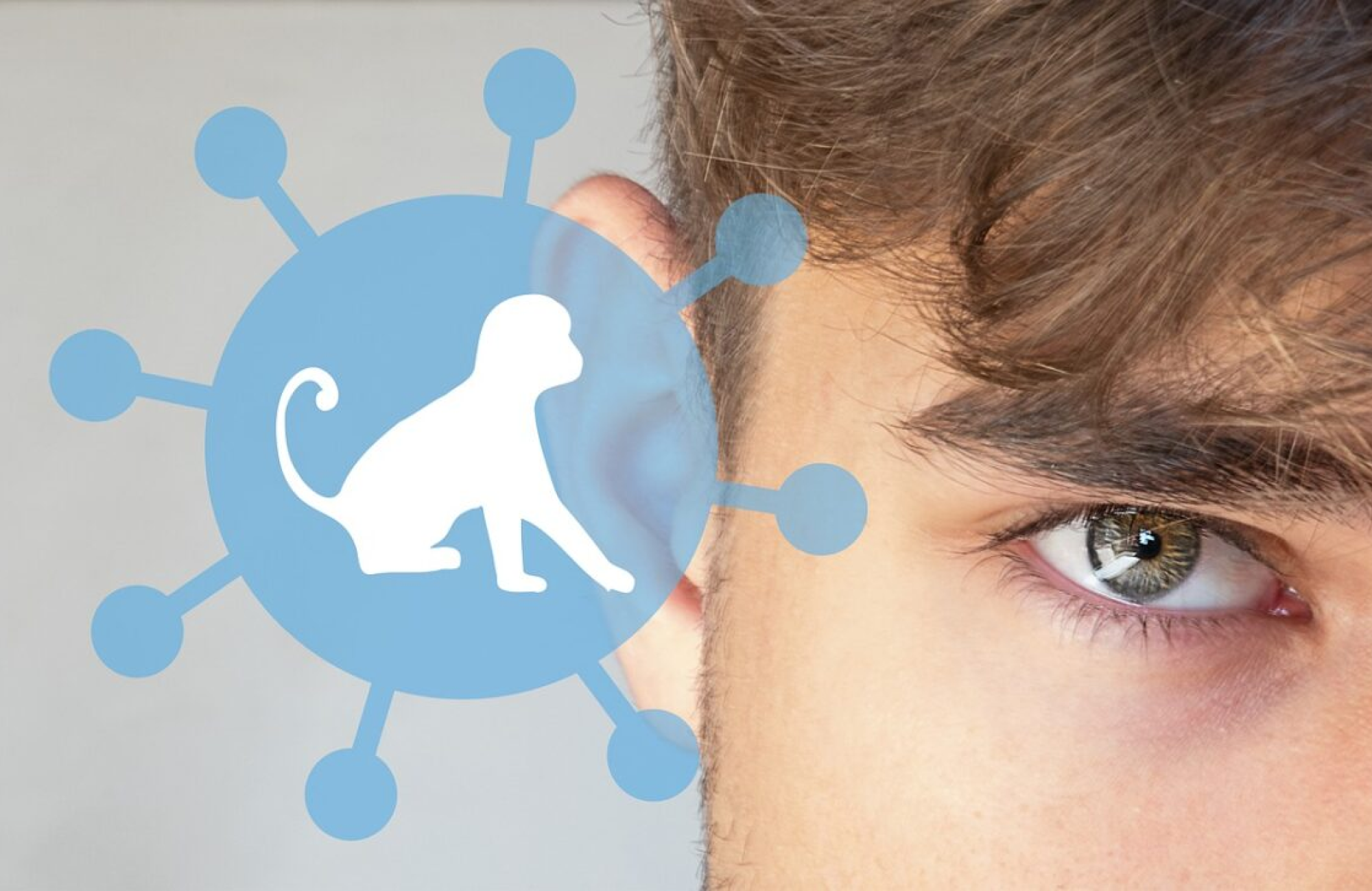 How Is Monkeypox Transmitted? Here’s What You Need to Know